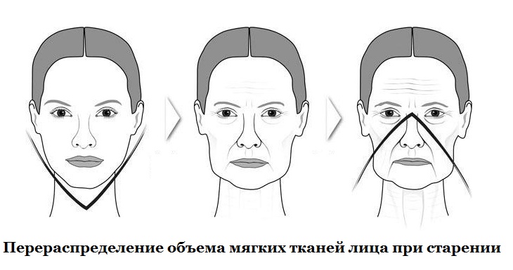 Нарушение барьерной функции кожи