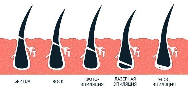 2. Безболезненность и комфорт
